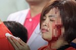 Nữ CĐV bị hành hung trong trận đấu Việt Nam - Indonesia, công an vào cuộc