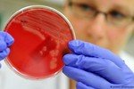 Phát hiện thêm ca nhiễm siêu vi khuẩn kháng mọi kháng sinh ở Mỹ