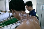 Nổ hoá chất ở chợ “tử thần” Kim Biên, 4 người bị bỏng