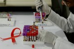 Các nhà nghiên cứu Cuba thử nghiệm vắc xin điều trị HIV/AIDS
