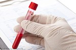 Phương pháp xét nghiệm máu mới giúp phát hiện ung thư từ rất sớm