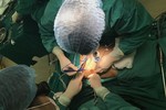 Bệnh viện K thực hiện thành công phẫu thuật nội soi 3D - 1 lỗ Trocart