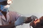 BVĐK Hương Khê: Gắp con đỉa dài 16 cm trong mũi bệnh nhân