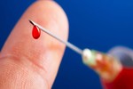 Virus HIV sống bao lâu trong bơm kim tiêm?