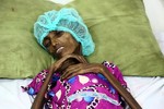 Yemen bên bờ vực nạn đói khủng khiếp nhất 100 năm qua