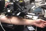 Công nghệ laser tiêu diệt tế bào ung thư