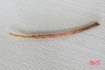 Xương cá dài 3,5 cm đâm thủng ruột một phụ nữ ở Hà Tĩnh