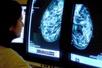 Hy vọng mới: Xét nghiệm máu phát hiện ung thư vú trước 5 năm khi có dấu hiệu bệnh
