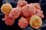 Công dụng diệt tế bào ung thư của nhiều loại thuốc không chữa ung thư