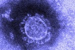 Nhật Bản cô lập thành công virus corona