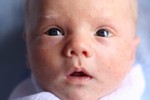 5 dấu hiệu nhận biết trẻ sơ sinh có làn da nhạy cảm