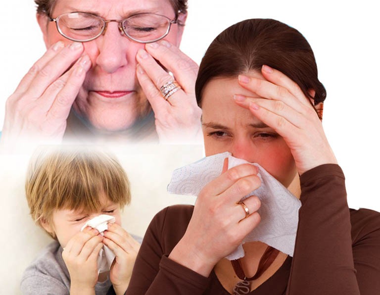 Nghẹt mũi hắt hơi là biểu hiện thường gặp của bệnh viêm mũi xoang do nấm.